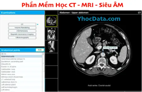 Phần Mềm Học CT – MRI – Siêu Âm