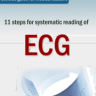 [Bản Dịch] 11 Bước Đọc ECG