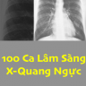 [Sách Dịch] 100 Ca Lâm Sàng X-Quang Ngực