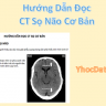 Hướng Dẫn Đọc CT Sọ Não Cơ Bản