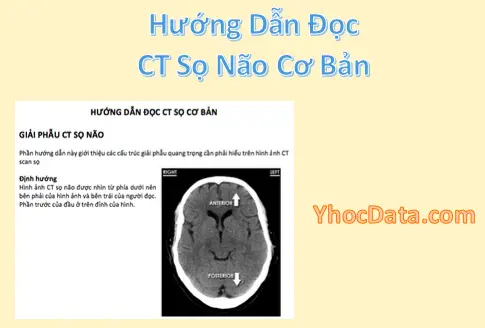 Hướng Dẫn Đọc CT Sọ Não Cơ Bản