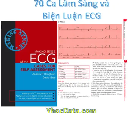 [Sách Dịch] 70 Ca Lâm Sàng Và Biện Luận Điện Tâm Đồ – ECG