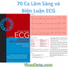 [Sách Dịch] 70 Ca Lâm Sàng Và Biện Luận Điện Tâm Đồ – ECG