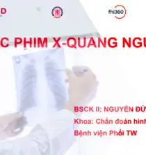 yhocdata.com Huong Dan Doc Phim X Quang Nguc YhocData.com