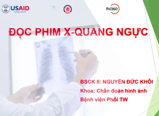 yhocdata.com Huong Dan Doc Phim X Quang Nguc YhocData.com