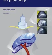 yhocdata.com Abdominal Ultrasound Step by Step