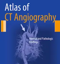 yhocdata.com Atlas of CT Angiography